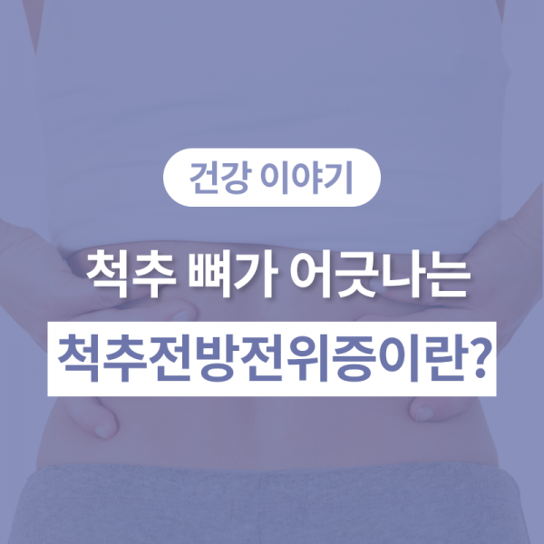 척추 뼈가 어긋나는 척추전방전위증이란?